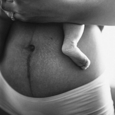 surrogate postpartum with stretch marks and scars on her beautiful belly, holding a newborn baby