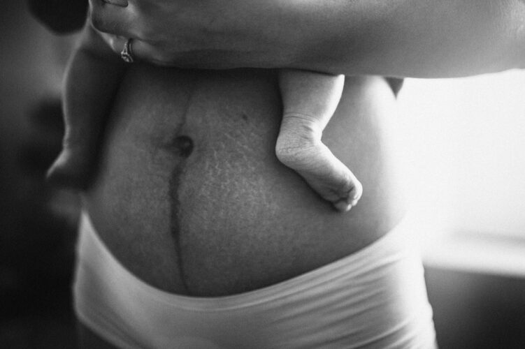 surrogate postpartum with stretch marks and scars on her beautiful belly, holding a newborn baby