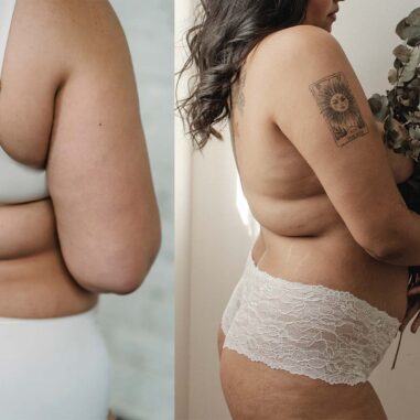 postpartum body