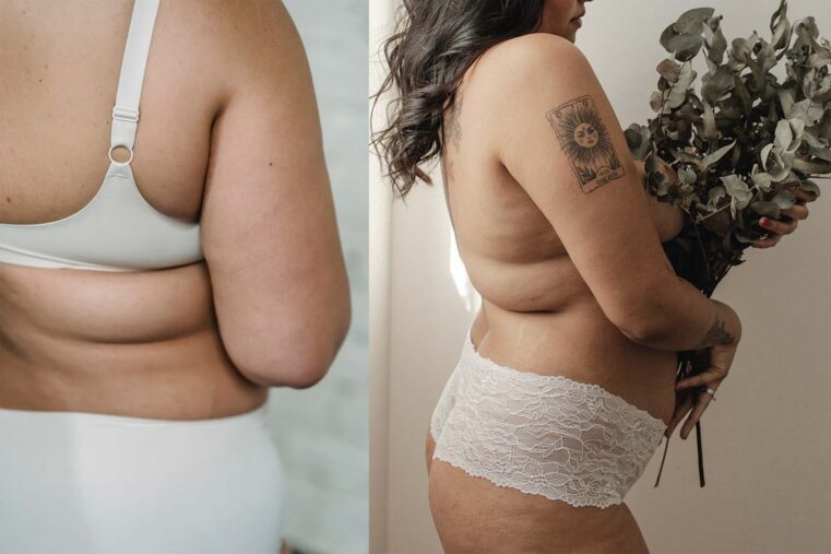 postpartum body
